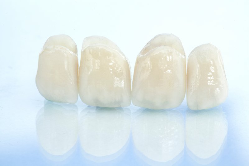 A closeup of ceramic dental crowns